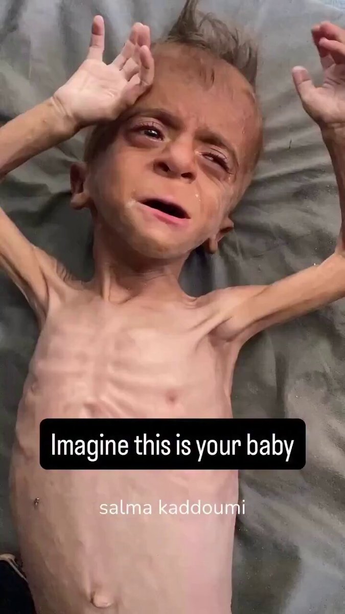 Too weak to cry, too dehydrated to shed a tear