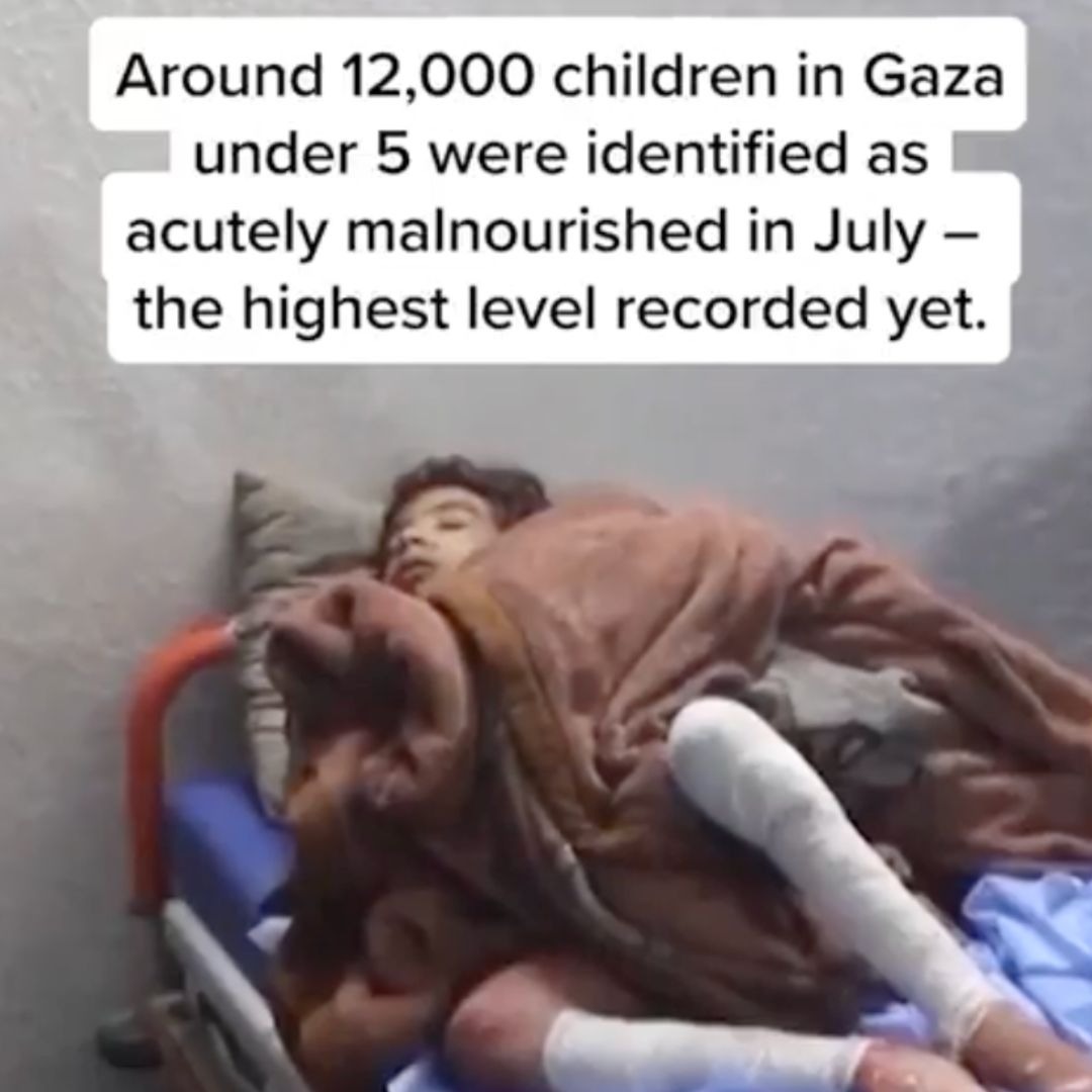 Maryam is 9 years old. Her weight has dropped to 9 kg and she can no ...