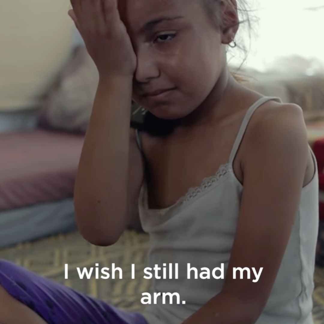 Sidra: I wish I still had my arm
