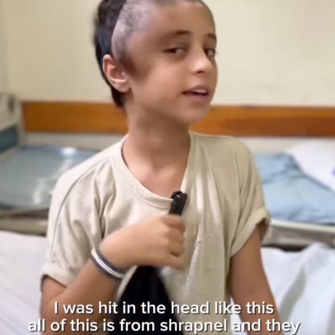 Maryam was hit in the head with shrapnel